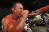 HAEMORRHAGE